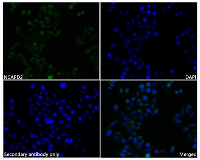 NCAPD2 Antibody in Immunocytochemistry (ICC/IF)