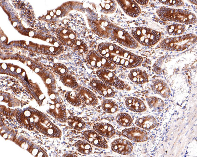 SCP2 Antibody in Immunohistochemistry (Paraffin) (IHC (P))