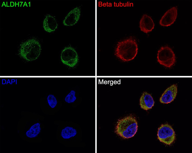 ALDH7A1 Antibody in Immunocytochemistry (ICC/IF)