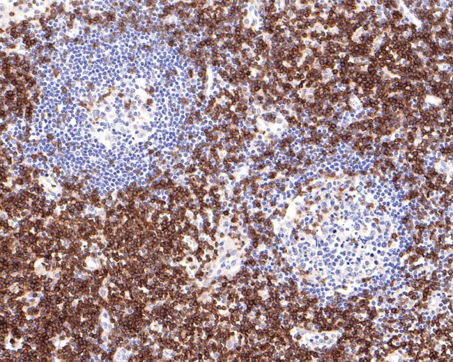 CD3 Antibody in Immunohistochemistry (Paraffin) (IHC (P))
