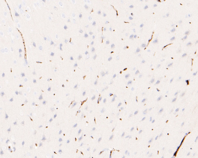 IRAK1 Antibody in Immunohistochemistry (Paraffin) (IHC (P))