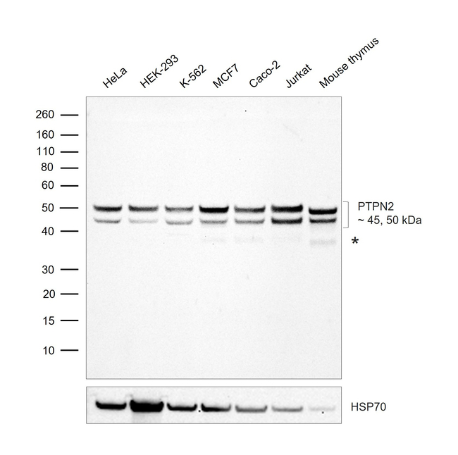 PTPN2 Antibody in Western Blot (WB)