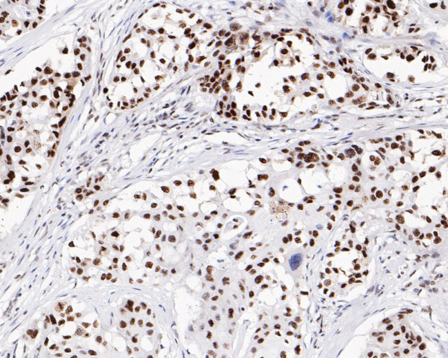 SR Antibody in Immunohistochemistry (Paraffin) (IHC (P))