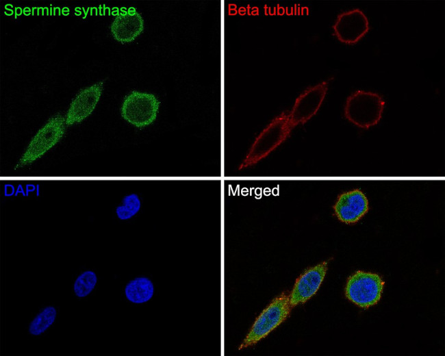 SMS Antibody in Immunocytochemistry (ICC/IF)