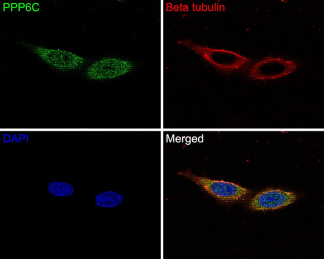 PPP6C Antibody in Immunocytochemistry (ICC/IF)