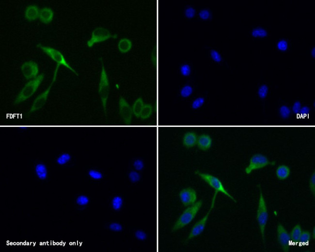 FDFT1 Antibody in Immunocytochemistry (ICC/IF)