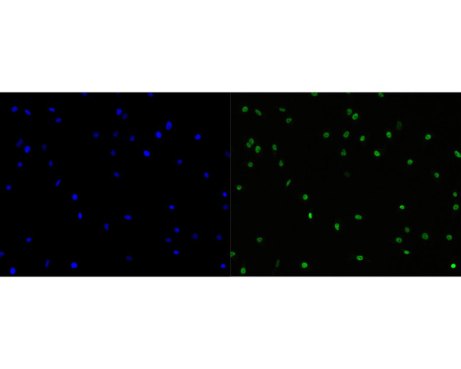 CDCA5 Antibody in Immunocytochemistry (ICC/IF)