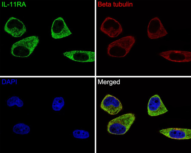 IL11RA Antibody in Immunocytochemistry (ICC/IF)