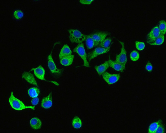 PRKCSH Antibody in Immunocytochemistry (ICC/IF)