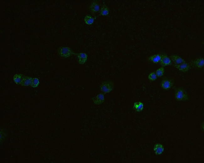 Adenylate Kinase 4 Antibody in Immunocytochemistry (ICC/IF)