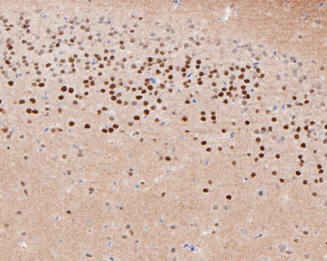 TUB Antibody in Immunohistochemistry (Paraffin) (IHC (P))