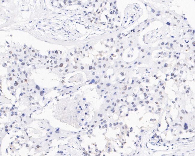 USP39 Antibody in Immunohistochemistry (Paraffin) (IHC (P))