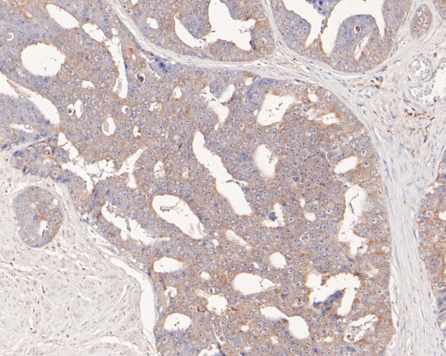 FKTN Antibody in Immunohistochemistry (Paraffin) (IHC (P))
