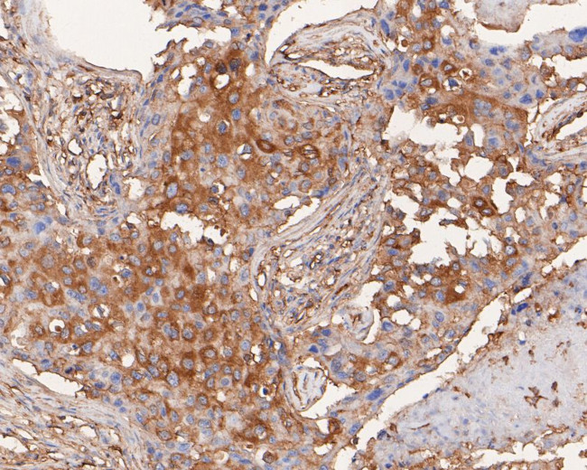 ARPC2 Antibody in Immunohistochemistry (Paraffin) (IHC (P))
