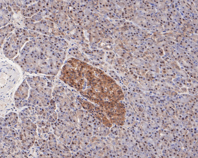 Tug Antibody in Immunohistochemistry (Paraffin) (IHC (P))