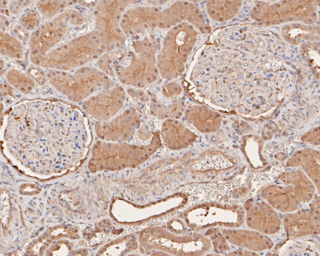 Rcl Tablet RCL Recombinant Monoclonal Antibody (JE59-29) (MA5-44893)