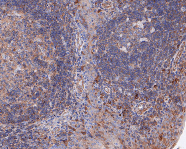ABH1 Antibody in Immunohistochemistry (Paraffin) (IHC (P))