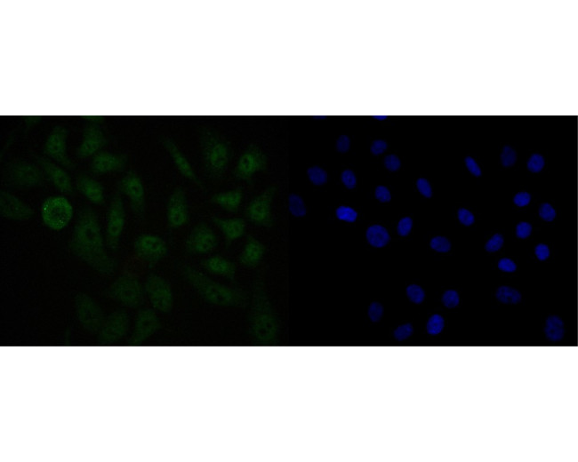 USP24 Antibody in Immunocytochemistry (ICC/IF)