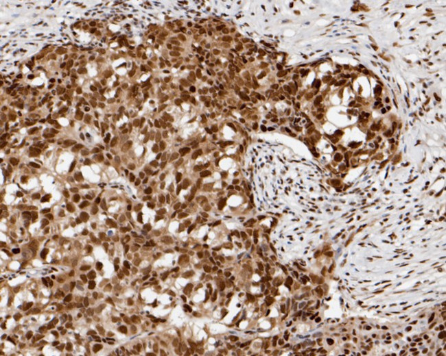 CHD3 Antibody in Immunohistochemistry (Paraffin) (IHC (P))