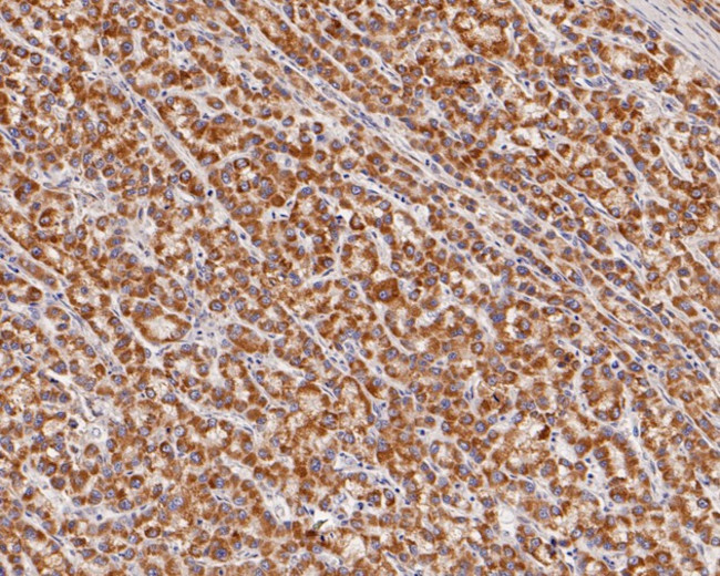 SUOX Antibody in Immunohistochemistry (Paraffin) (IHC (P))