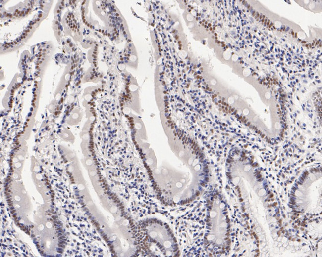 MED4 Antibody in Immunohistochemistry (Paraffin) (IHC (P))