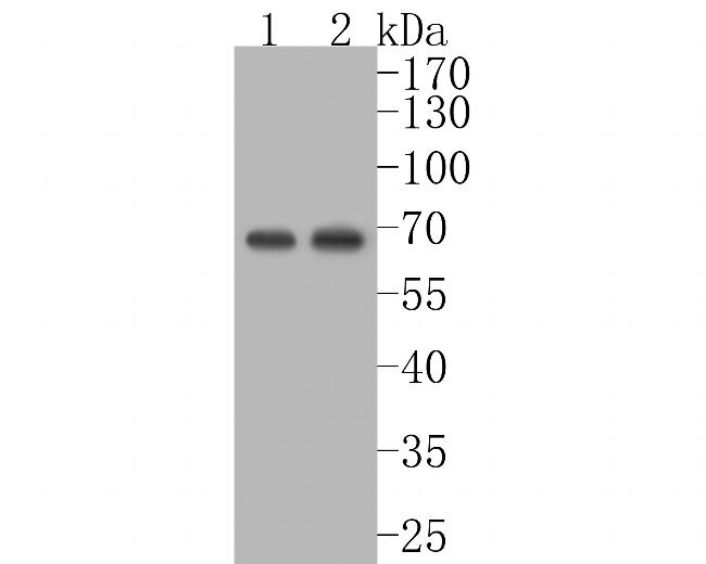 IGF2BP2 Antibody in Western Blot (WB)