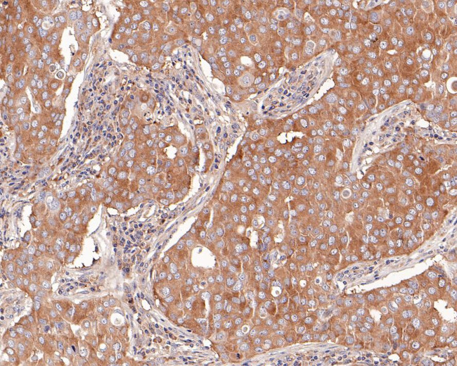 TCP-1 delta Antibody in Immunohistochemistry (Paraffin) (IHC (P))