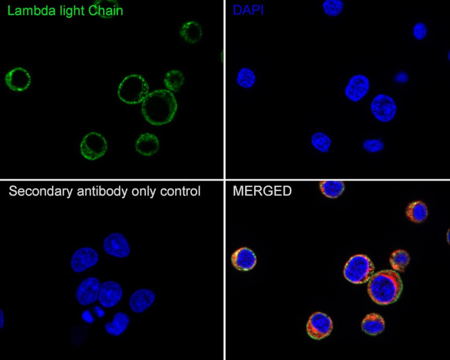 Lambda light chain Antibody in Immunocytochemistry (ICC/IF)