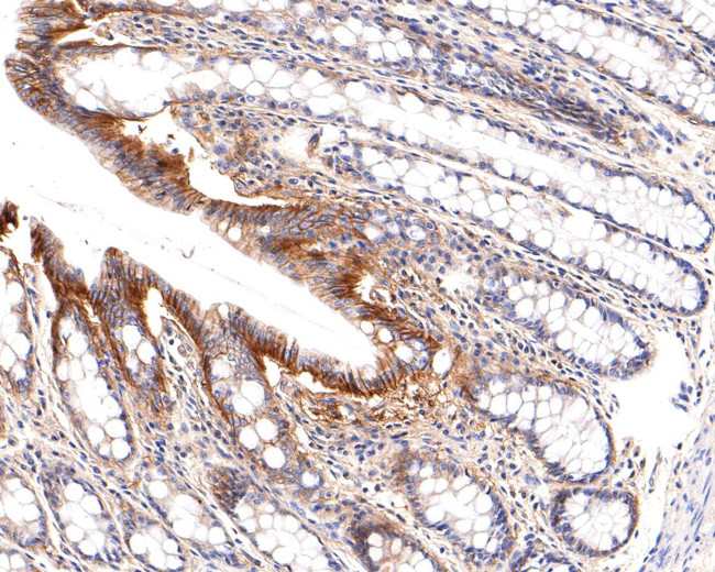 SLC7A11 Monoclonal Antibody A7C6 MA5 44962 slc7a11-monoclonal-antibody-a7c6-ma5-44962