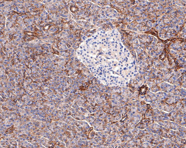 SLC7A11 Monoclonal Antibody A7C6 MA5 44962 slc7a11-monoclonal-antibody-a7c6-ma5-44962