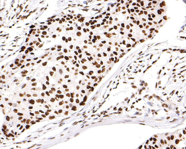 H3K18ac Antibody in Immunohistochemistry (Paraffin) (IHC (P))