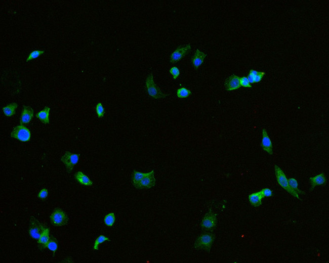 TROP2 Antibody in Immunocytochemistry (ICC/IF)