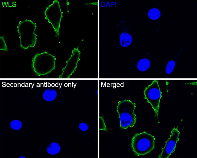 GPR177 Antibody in Immunocytochemistry (ICC/IF)