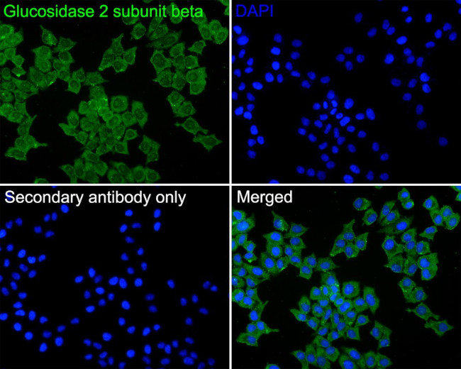 PRKCSH Antibody in Immunocytochemistry (ICC/IF)