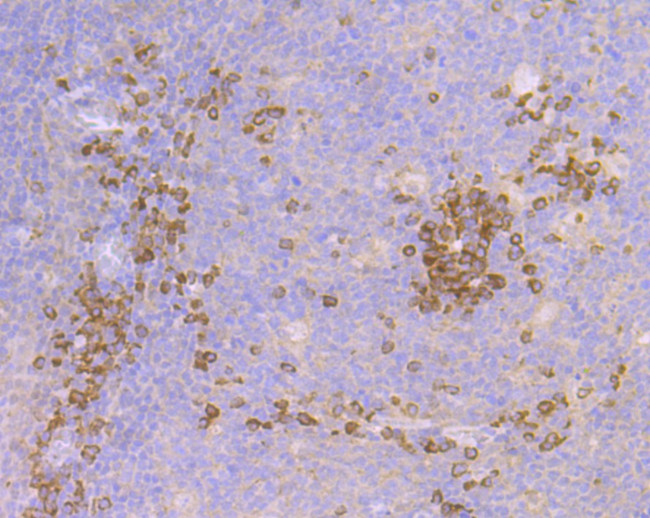 Cullin 2 Antibody in Immunohistochemistry (Paraffin) (IHC (P))