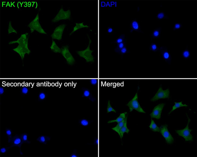 Phospho-FAK (Tyr397) Antibody in Immunocytochemistry (ICC/IF)