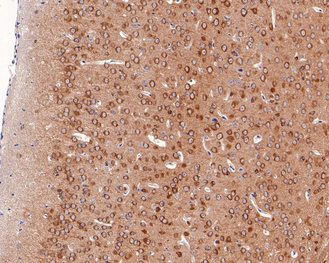 Phospho-Tau-F (Thr231) Antibody in Immunohistochemistry (Paraffin) (IHC (P))