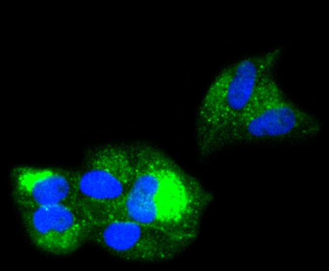 beta-2 Microglobulin Antibody in Immunocytochemistry (ICC/IF)