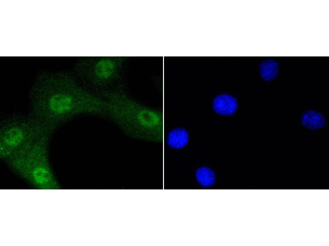 Phospho-AKT1 (Ser473) Antibody in Immunocytochemistry (ICC/IF)