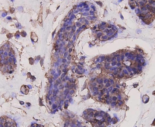 AKT1 Antibody in Immunohistochemistry (Paraffin) (IHC (P))