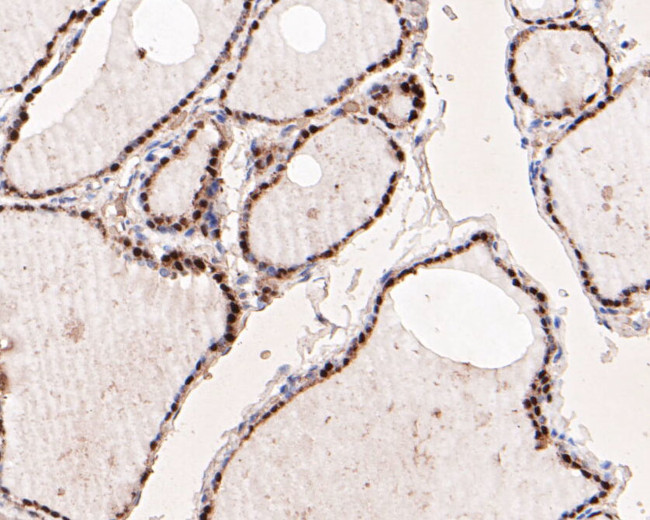 PAX8 Antibody in Immunohistochemistry (Paraffin) (IHC (P))