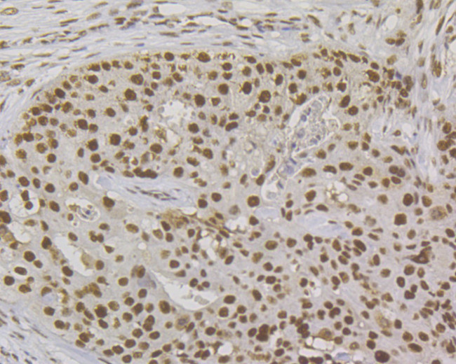 MSH2 Antibody in Immunohistochemistry (Paraffin) (IHC (P))