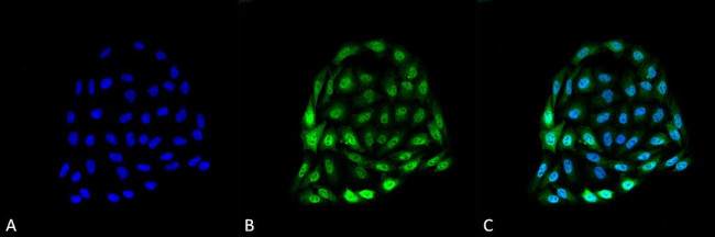 HSP70 Antibody in Immunocytochemistry (ICC/IF)