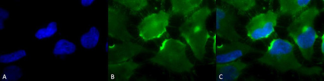 CD74 Antibody in Immunocytochemistry (ICC/IF)
