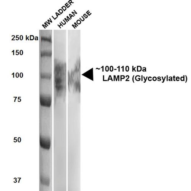 CD107b (LAMP-2) Antibody in Western Blot (WB)