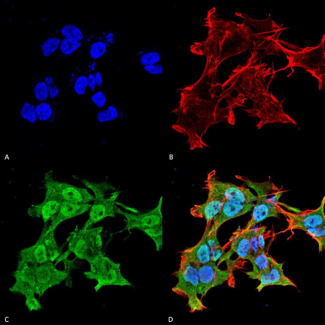 Alpha A Crystallin Antibody in Immunocytochemistry (ICC/IF)