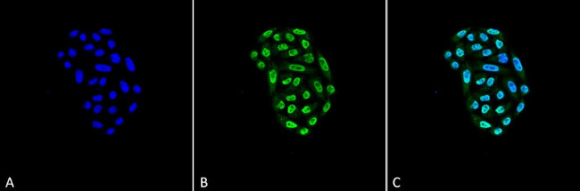 HSP70 Antibody in Immunocytochemistry (ICC/IF)