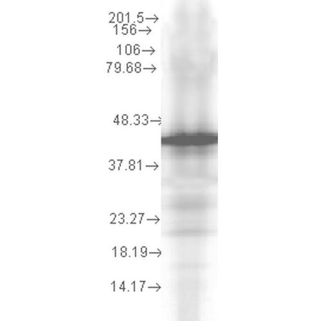 HSP40 Antibody in Western Blot (WB)