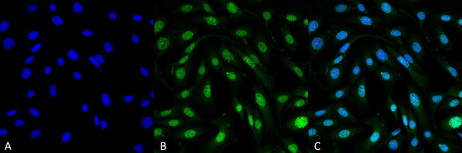 MDC1 Antibody in Immunocytochemistry (ICC/IF)