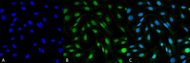 MDC1 Antibody in Immunocytochemistry (ICC/IF)